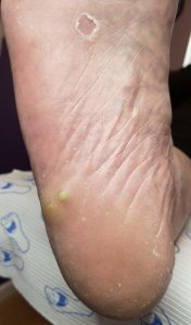 Foot with unknown problem